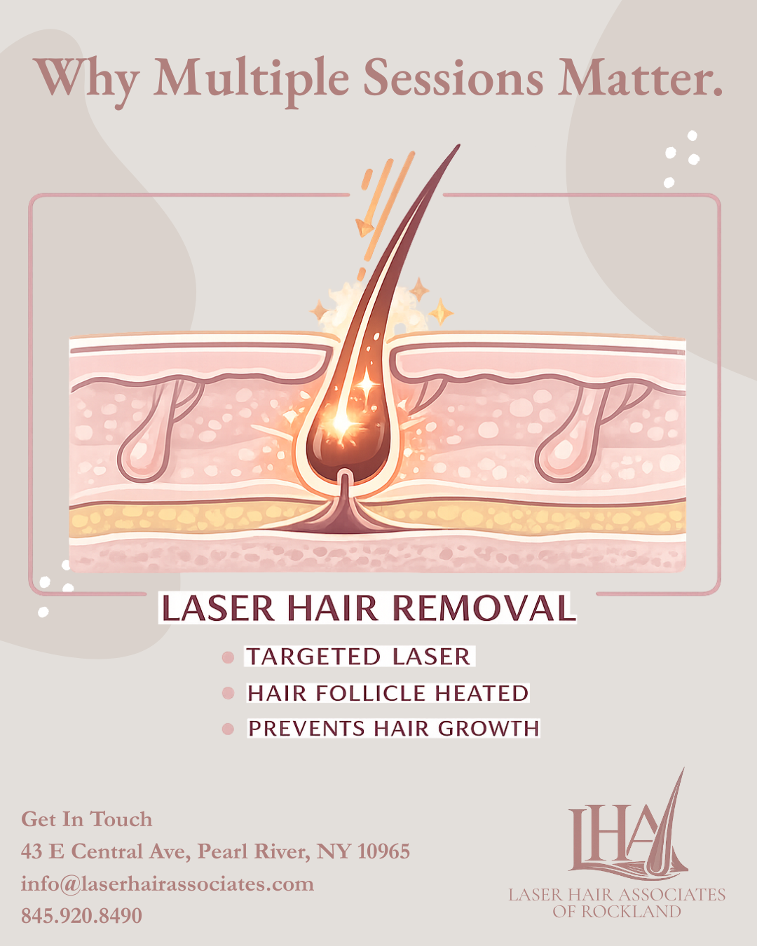 Laser Hair Associates why multiple sessions matter educational graphic